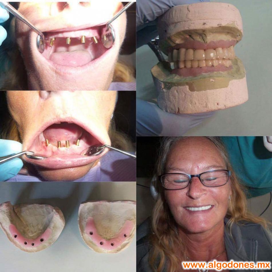 Los Algodones Mexico, Algodones mexico Los algodones algodones info