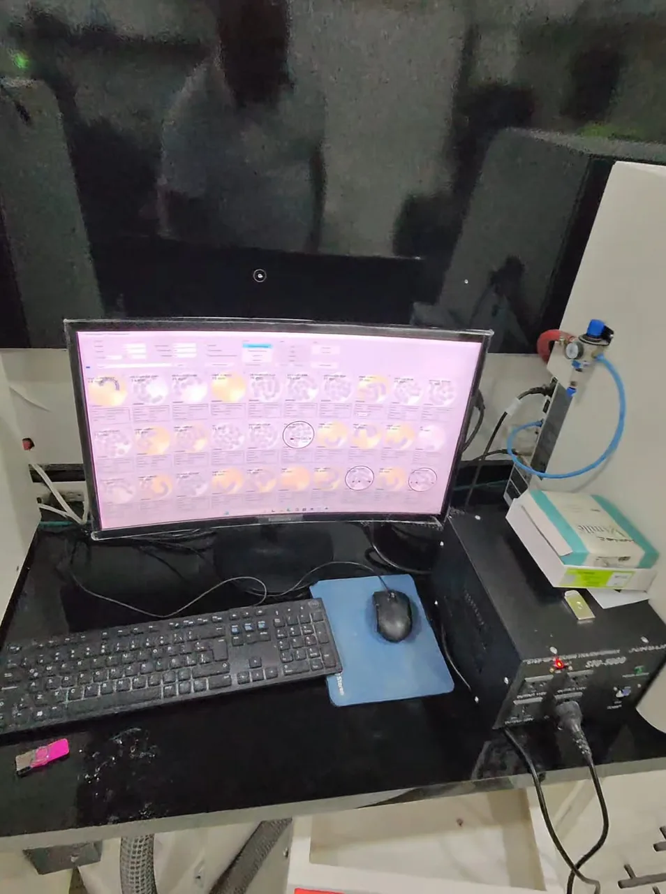 CAD/CAM digital crown design at Innova Dental, Los Algodones