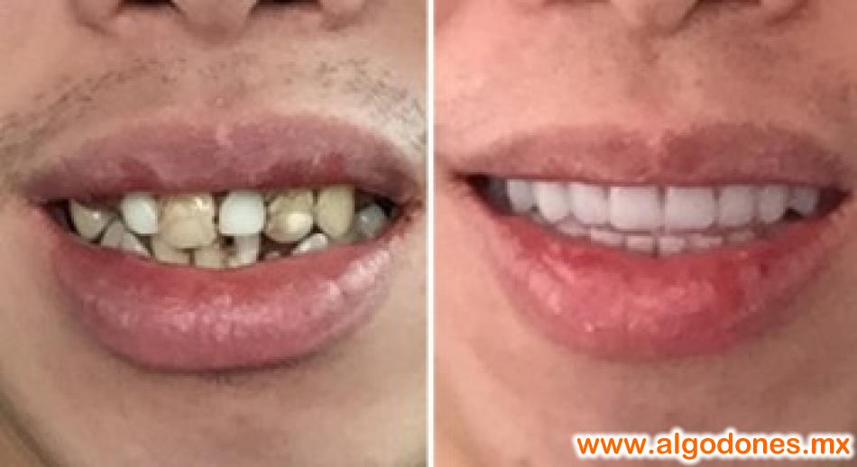 Dental Solutions Xochipilli Bojorquez DDS