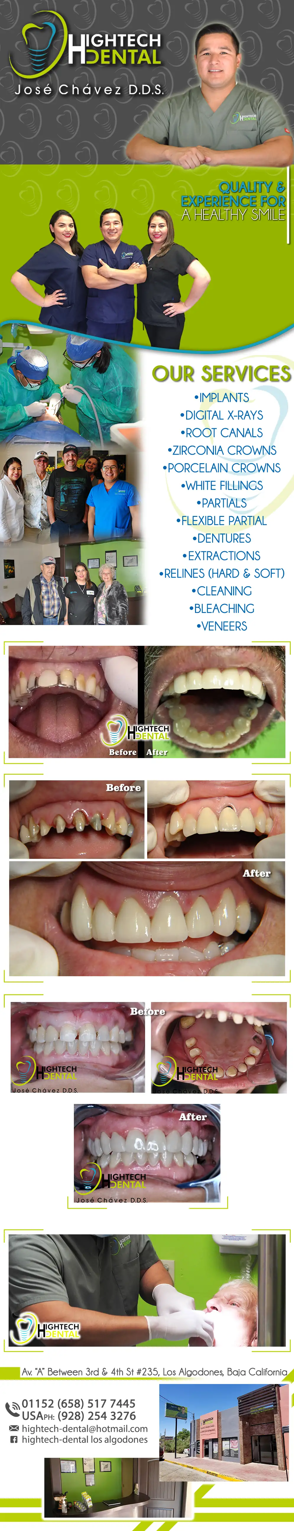 HIGHTECH DENTAL José Chávez D.D.S. - Dentists in Los Algodones